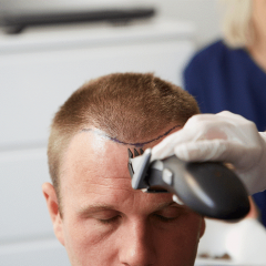 Turkey: The Country To Get A Hair Transplant